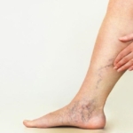 Varislerden Kurtulma Yontemleri