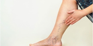 Varislerden Kurtulma Yontemleri